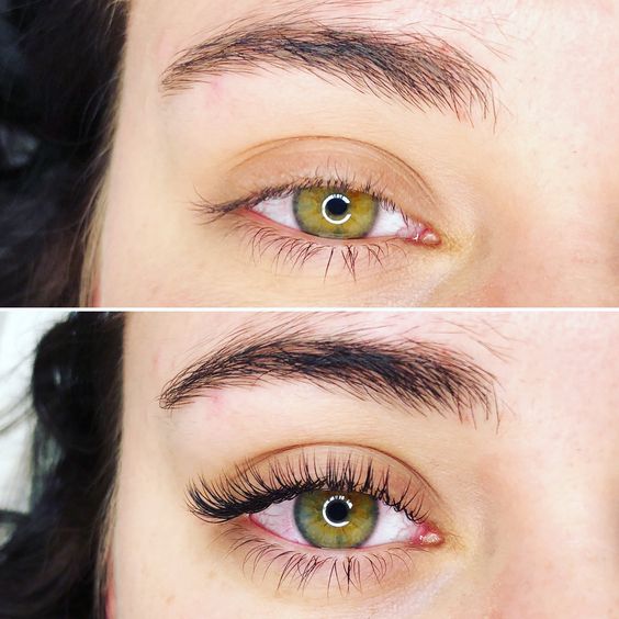 Before And After Classic Lash Extensions 1